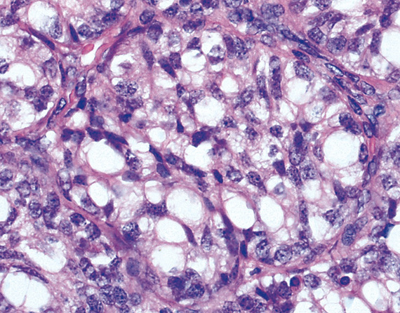 TRIAVET oncologia sant cugat del valles